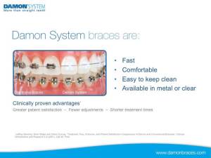 Informative image of braces treatment